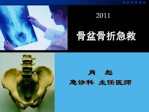 骨盆骨折急救PPT课件