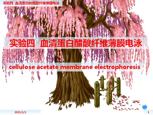 实验四 血清蛋白的醋酸纤维薄膜电泳精品PPT课件