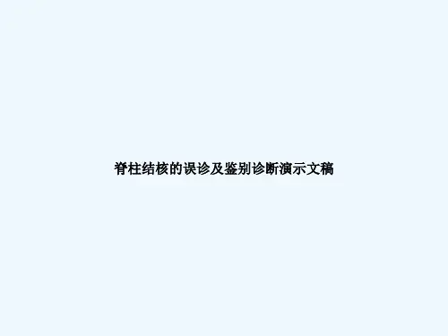 脊柱结核的误诊及鉴别诊断演示文稿