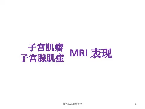 子宫肌瘤与腺肌症