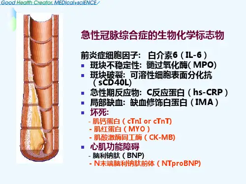 超敏cTnI-