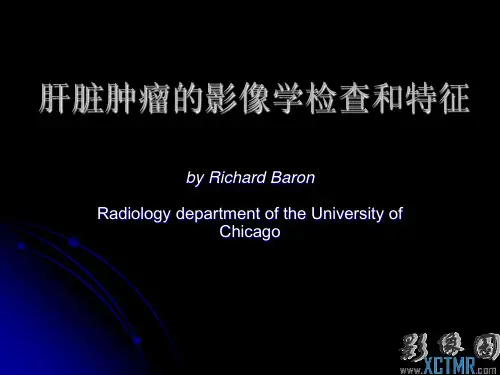 肝脏肿瘤的影像学检查和特征