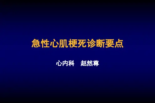 急性心肌梗死诊断要点