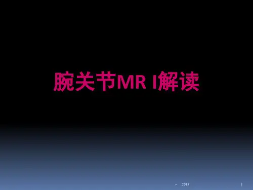 腕关节解读ppt课件