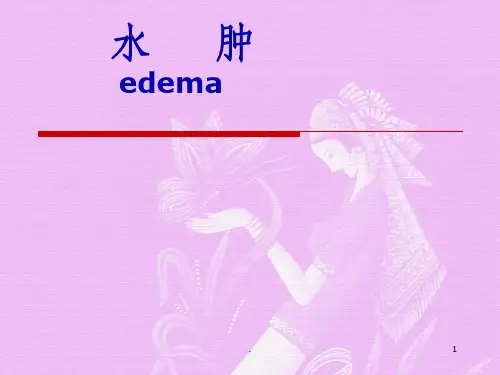 诊断学水肿ppt课件