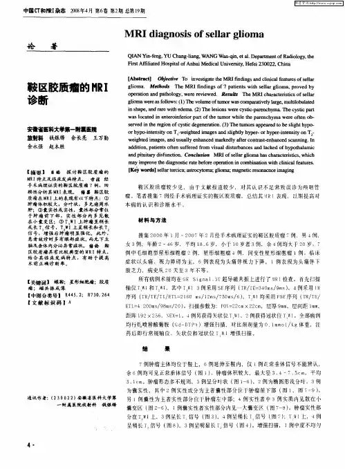 鞍区胶质瘤的MRI诊断
