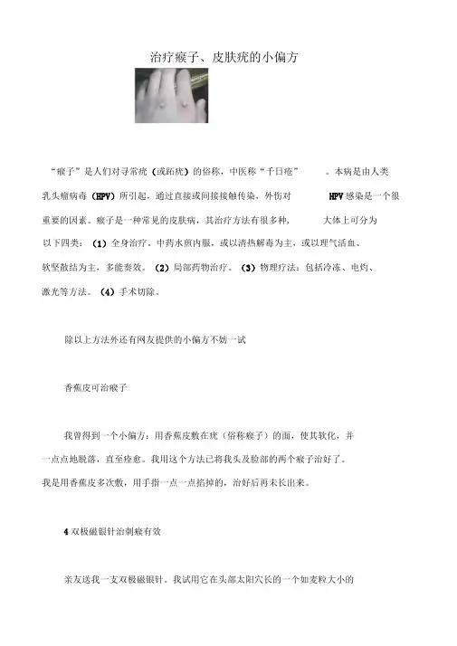 治疗瘊子皮肤疣的小偏方