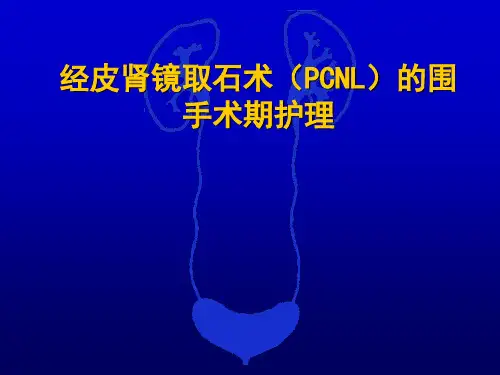 经皮肾镜碎石取石术围手术期护理ppt课件