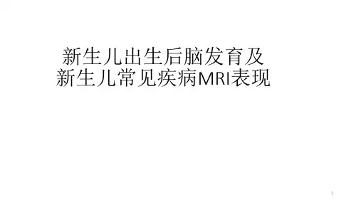 新生儿出生后脑发育及新生儿常见疾病MRI表现ppt课件