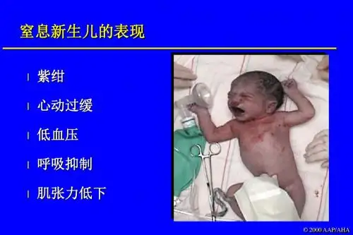 新生儿与复苏PPT课件