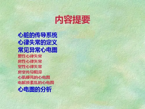 常见异常心电图的识别