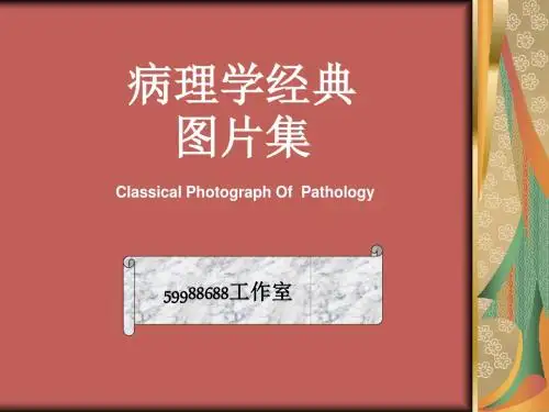 2019年病理学经典图片集.ppt