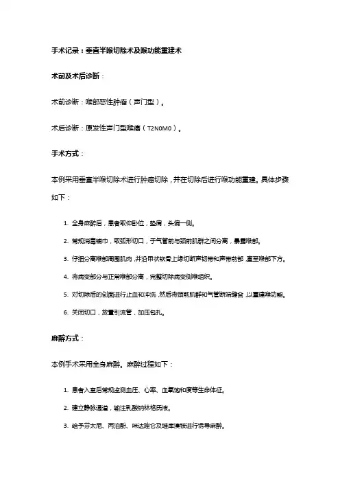手术记录：垂直半喉切除术及喉功能重建术