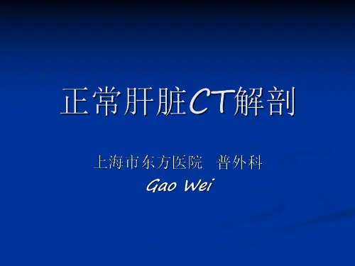医学影像-正常肝脏CT解剖