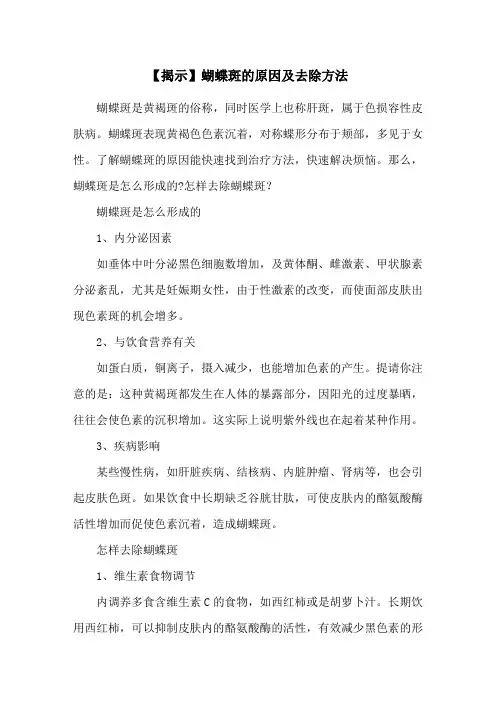 【揭示】蝴蝶斑的原因及去除方法