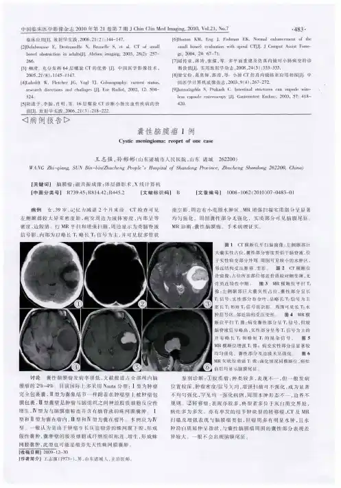 囊性脑膜瘤1例