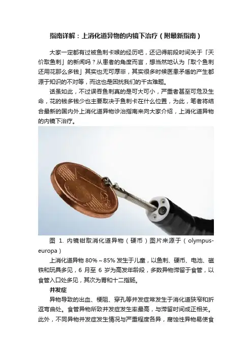 指南详解：上消化道异物的内镜下治疗（附最新指南）