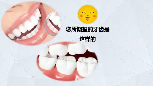 115龋病概述口腔组织病理学