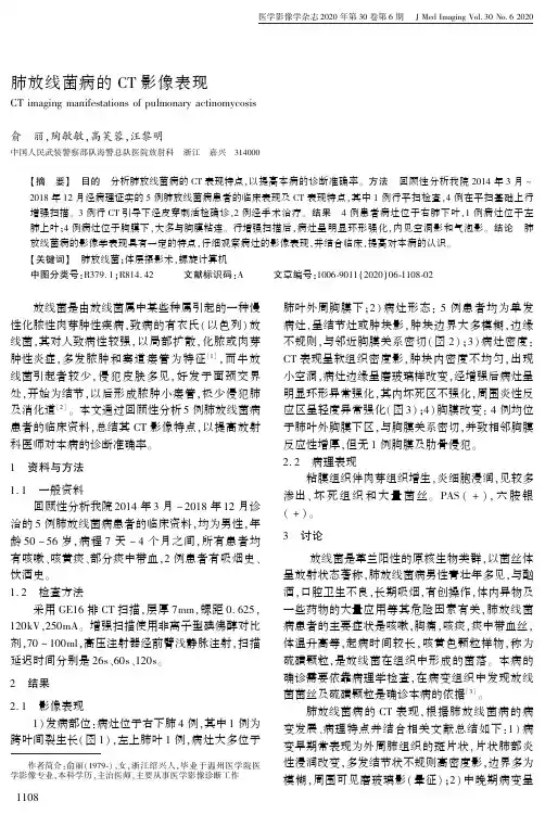 肺放线菌病的CT影像表现