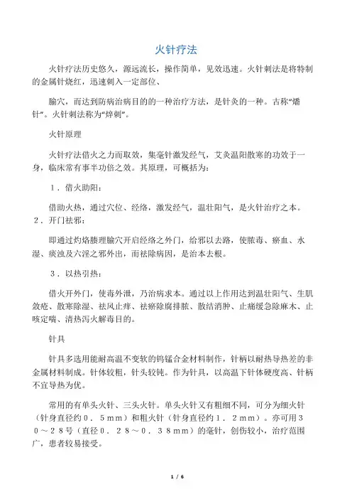 火针疗法