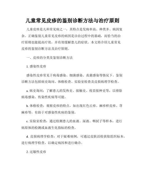 儿童常见皮疹的鉴别诊断方法与治疗原则