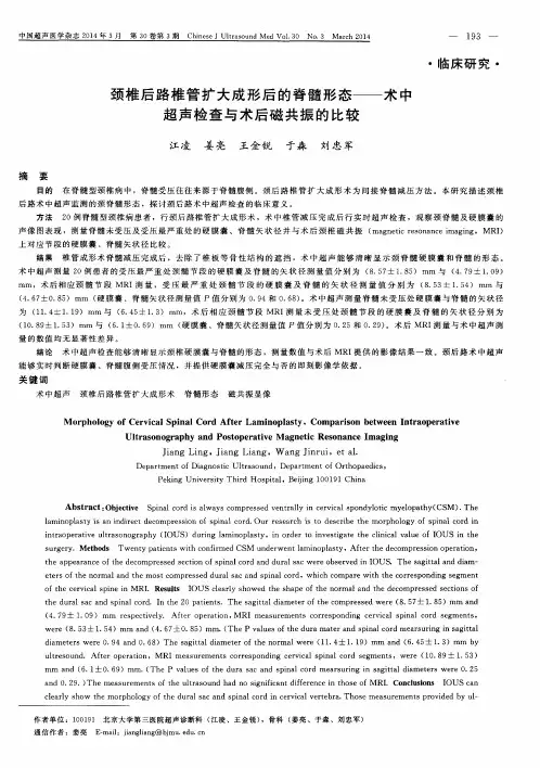颈椎后路椎管扩大成形后的脊髓形态——术中超声检查与术后磁共振的比较