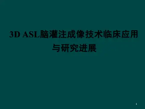 ASL脑灌注成像技术临床应用及研究进展ppt课件