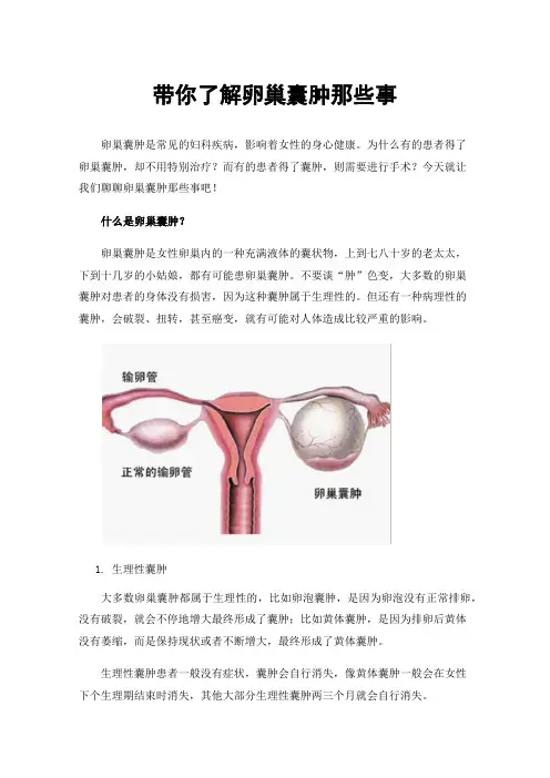 带你了解卵巢囊肿那些事