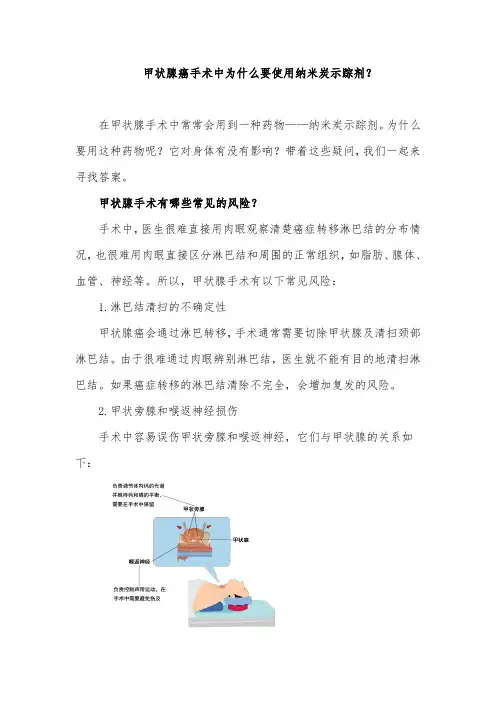甲状腺癌手术中为什么要使用纳米炭示踪剂？