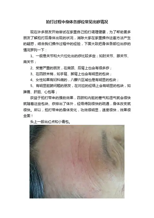 拍打过程中身体各部位常见出痧情况