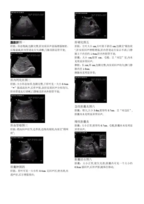 超声诊断报告描述及图片