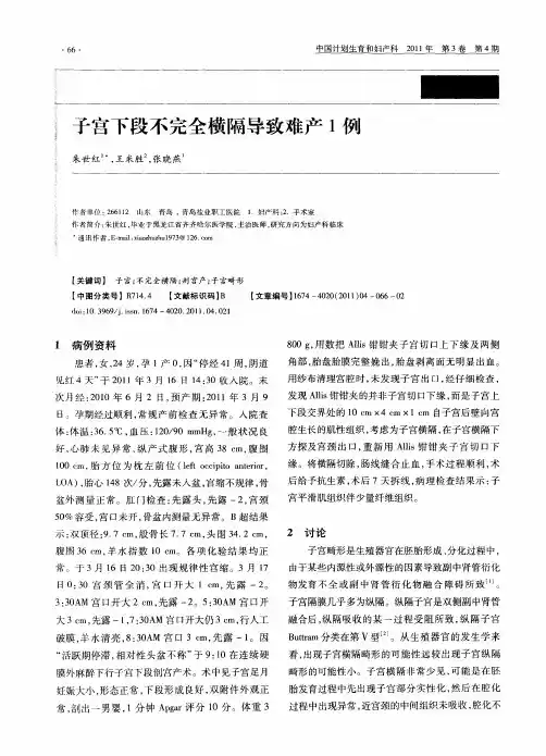 子宫下段不完全横隔导致难产1例
