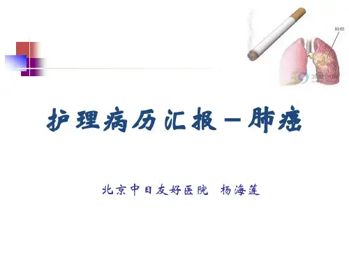 护理病历汇报---肺癌