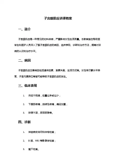 子宫腺肌症讲课教案