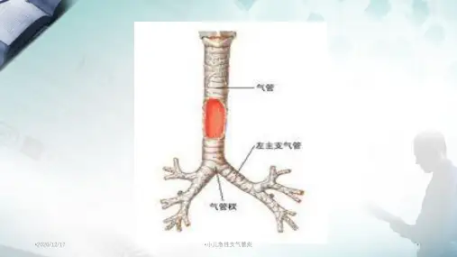 小儿急性支气管炎精选PPT干货