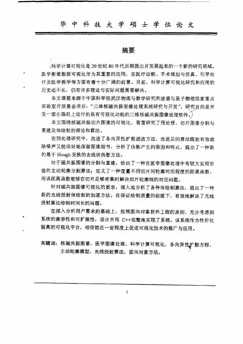 三维核磁共振图像处理系统研究及实现