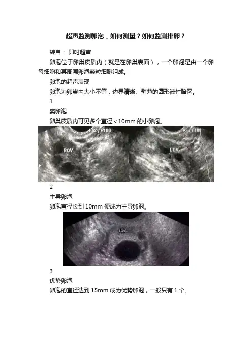 超声监测卵泡，如何测量？如何监测排卵？