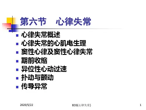ECG心律失常