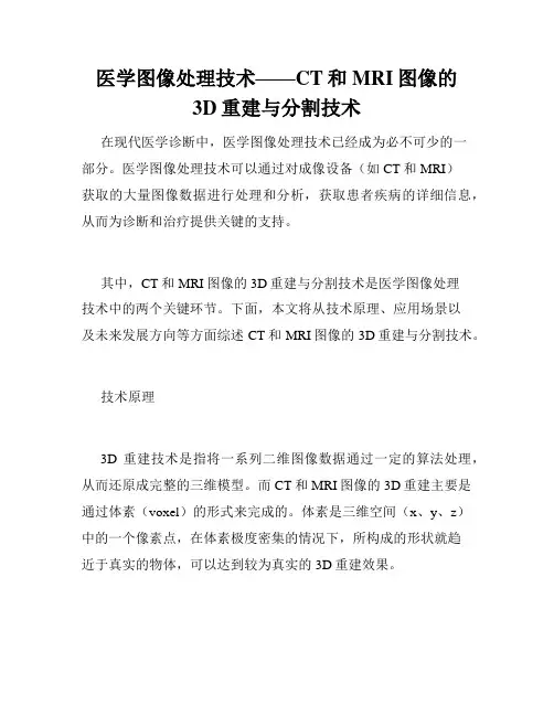 医学图像处理技术——CT和MRI图像的3D重建与分割技术