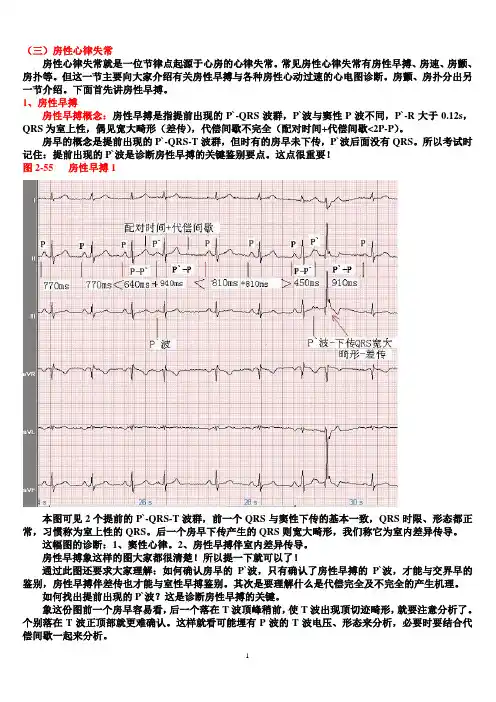 另类心电图讲义-3---房性心律失常