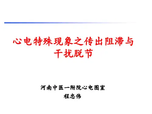 心电特殊现象之传出阻滞与干扰脱节