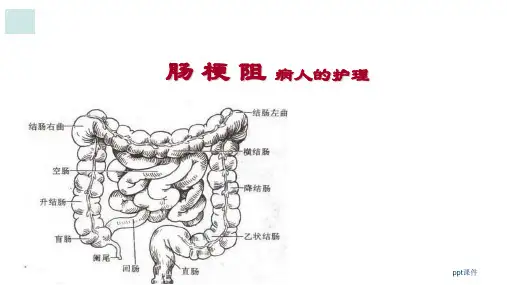 外科护理学-肠梗阻病人的护理  ppt课件