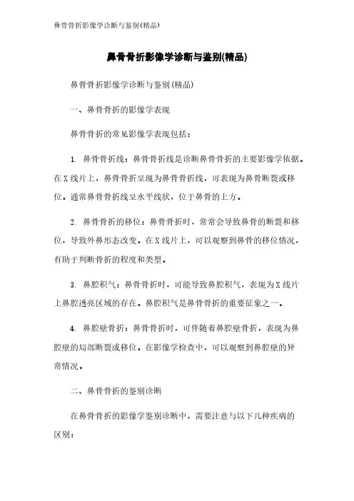鼻骨骨折影像学诊断与鉴别(精品)
