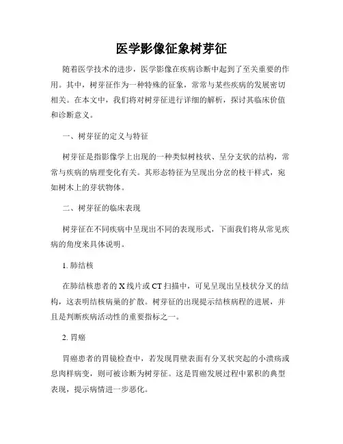 医学影像征象树芽征