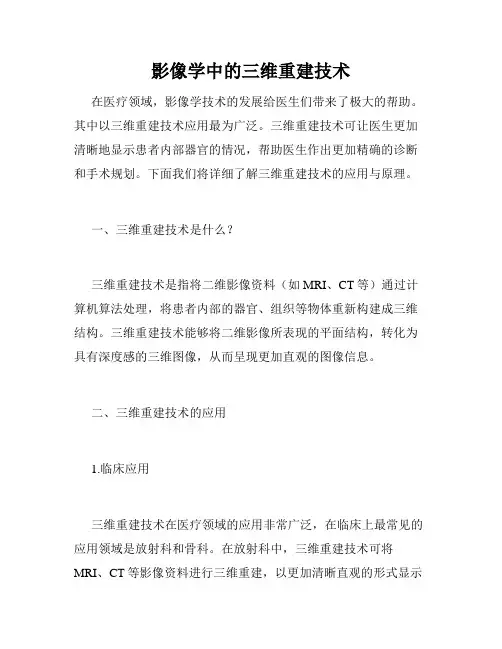 影像学中的三维重建技术