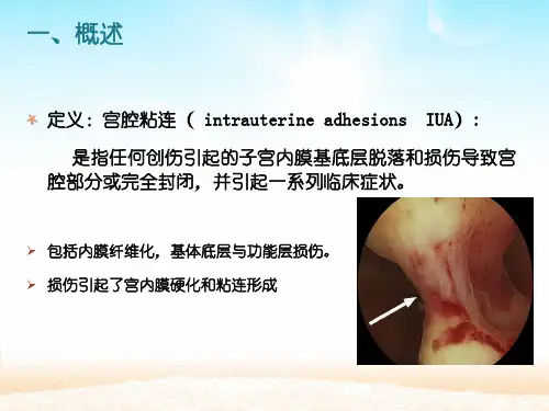 重宫腔粘连的诊治课件-PPT