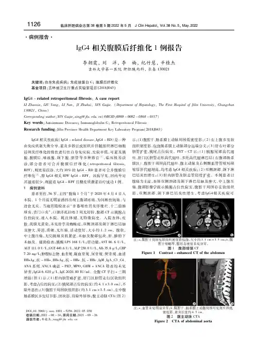 IgG4相关腹膜后纤维化1例报告