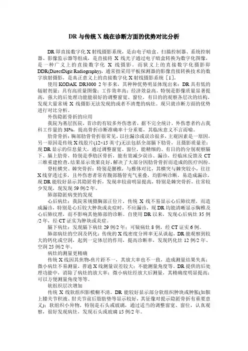 DR与传统X线在诊断方面的优势对比分析