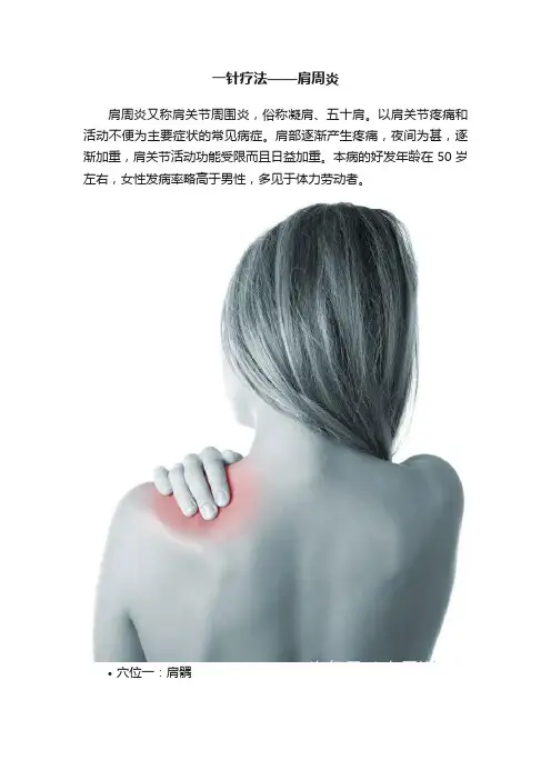 一针疗法——肩周炎