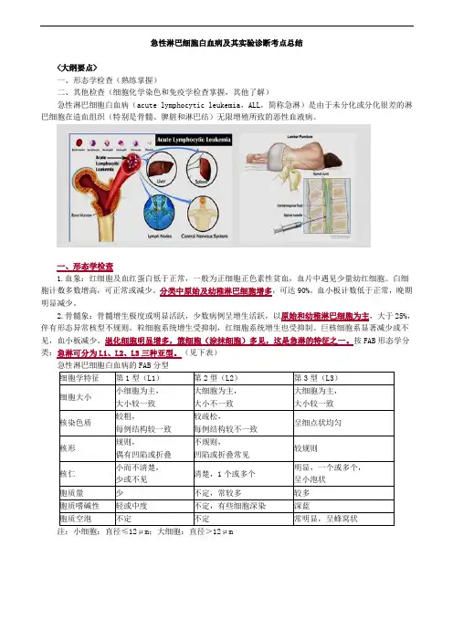 急性淋巴细胞白血病及其实验诊断考点总结